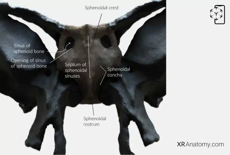 AR Figure 33 – Sphenoid Bone: Body of sphenoid bone