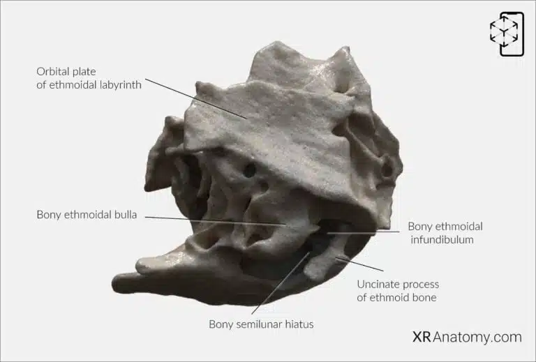AR Figure 45 – Ethmoid bone: Lateral view