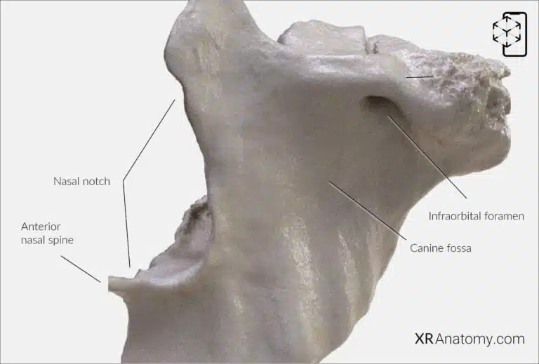 AR Figure 54 – Maxilla: Anterior Surface