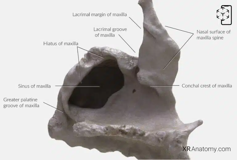 AR Figure 56 – Maxilla: Nasal Surface