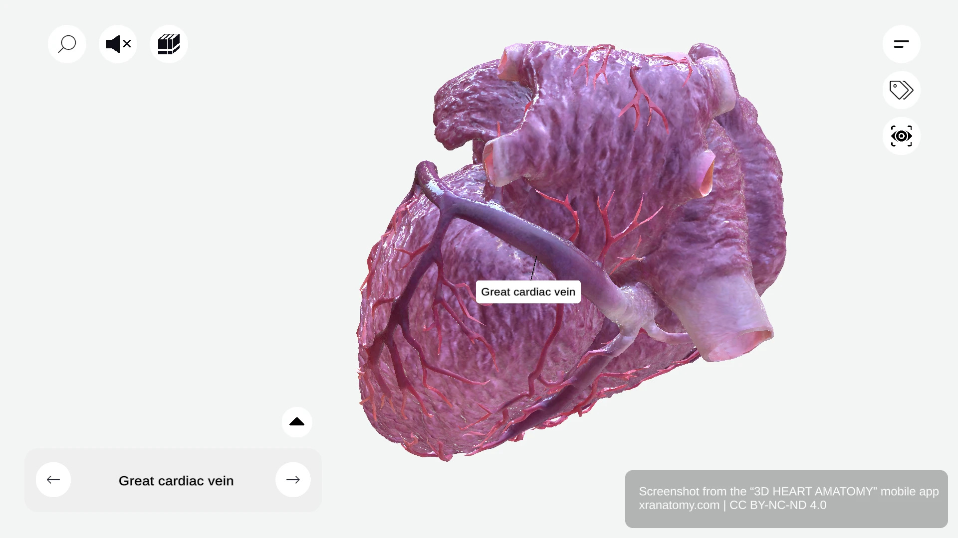 Great cardiac vein anatomy coursing in left atrioventricular groove alongside left circumflex artery