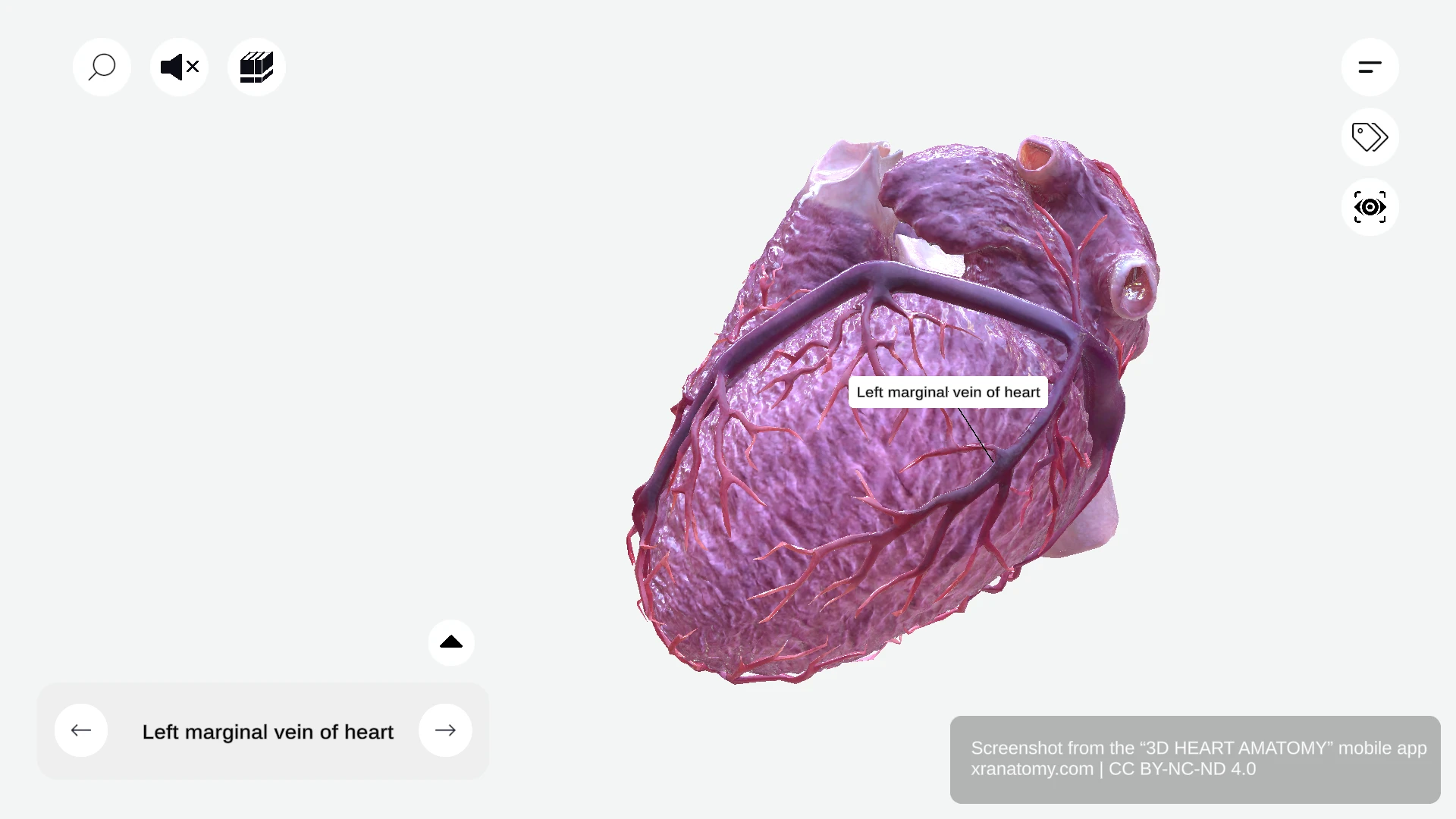 Left marginal vein anatomy draining lateral and posterior wall of left ventricle