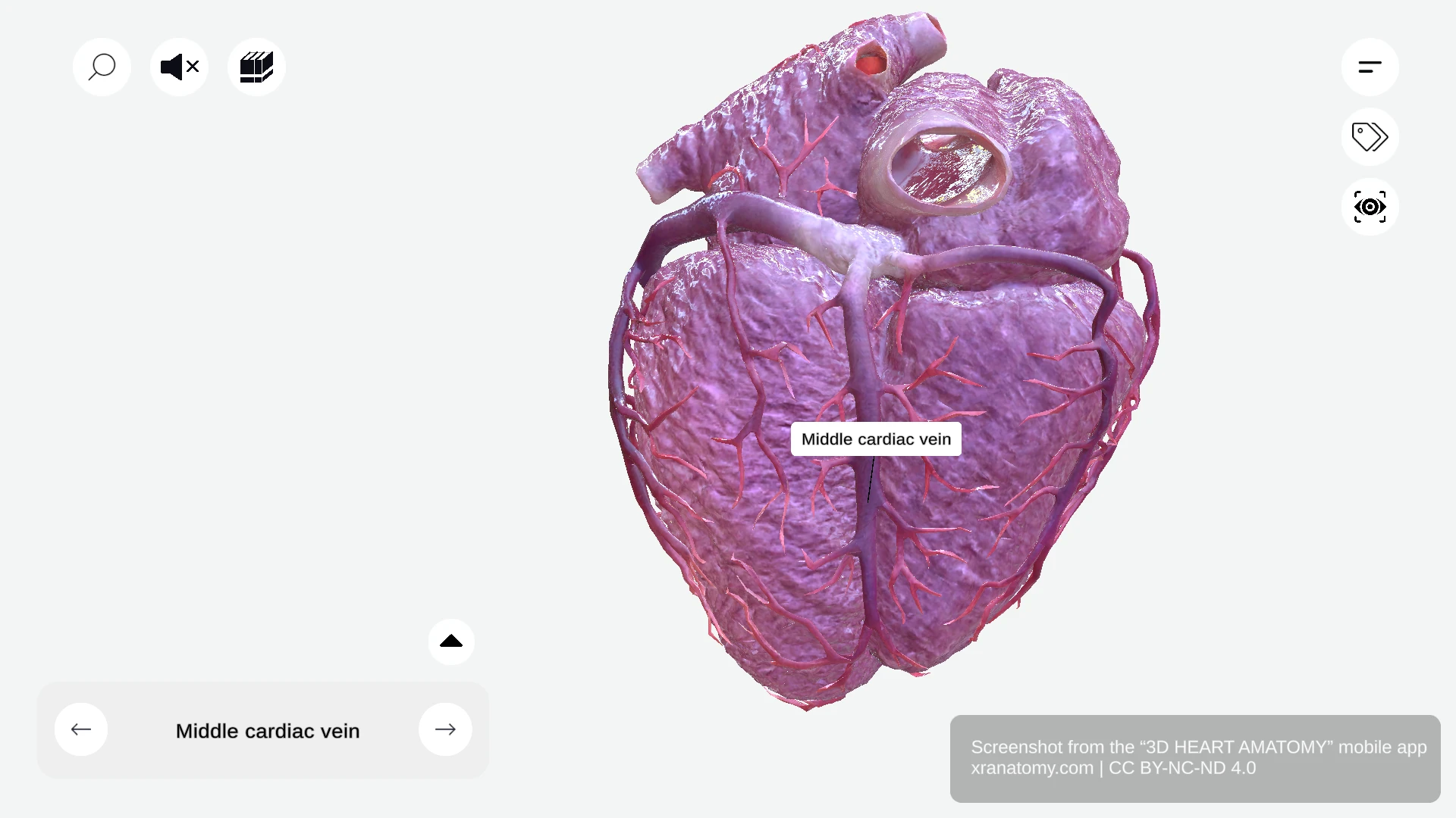 Middle cardiac vein anatomy ascending with posterior interventricular artery draining into coronary sinus