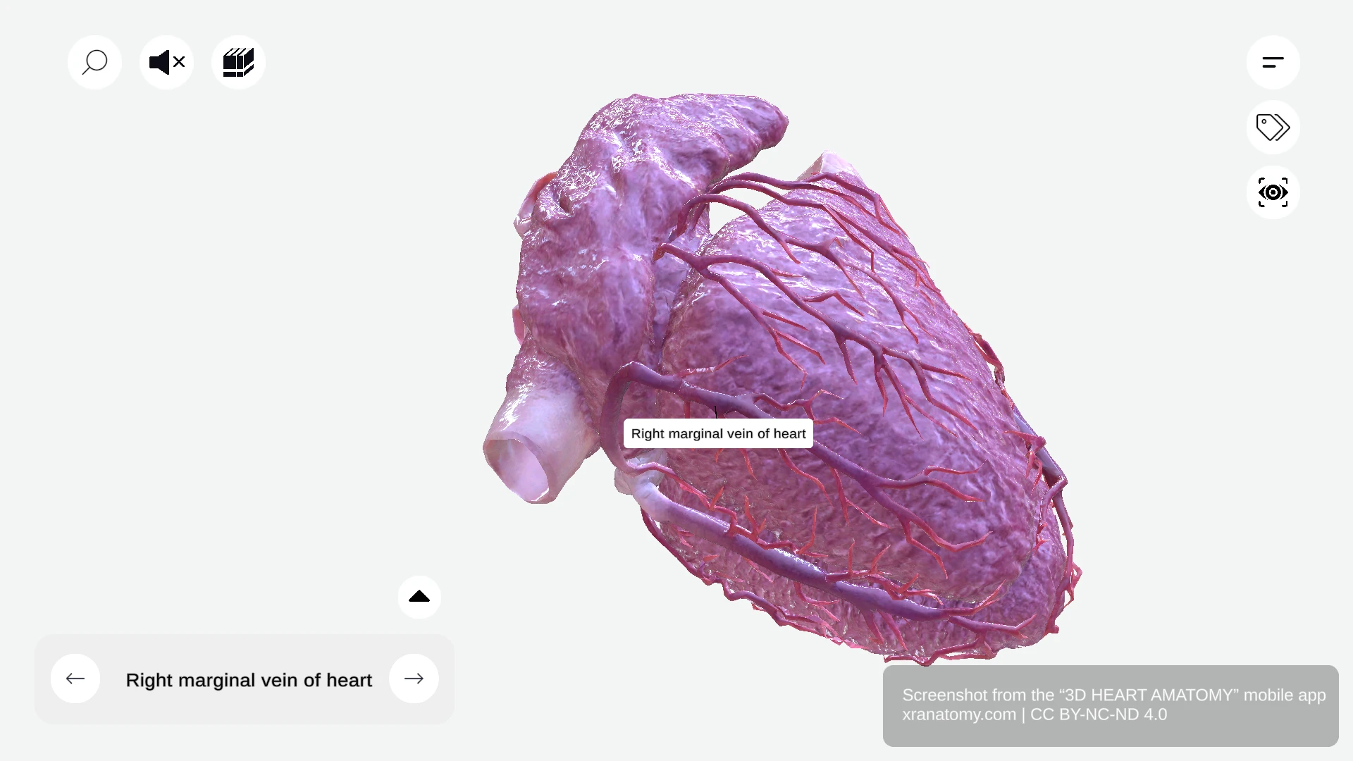 Right marginal vein anatomy following lateral wall of right ventricle