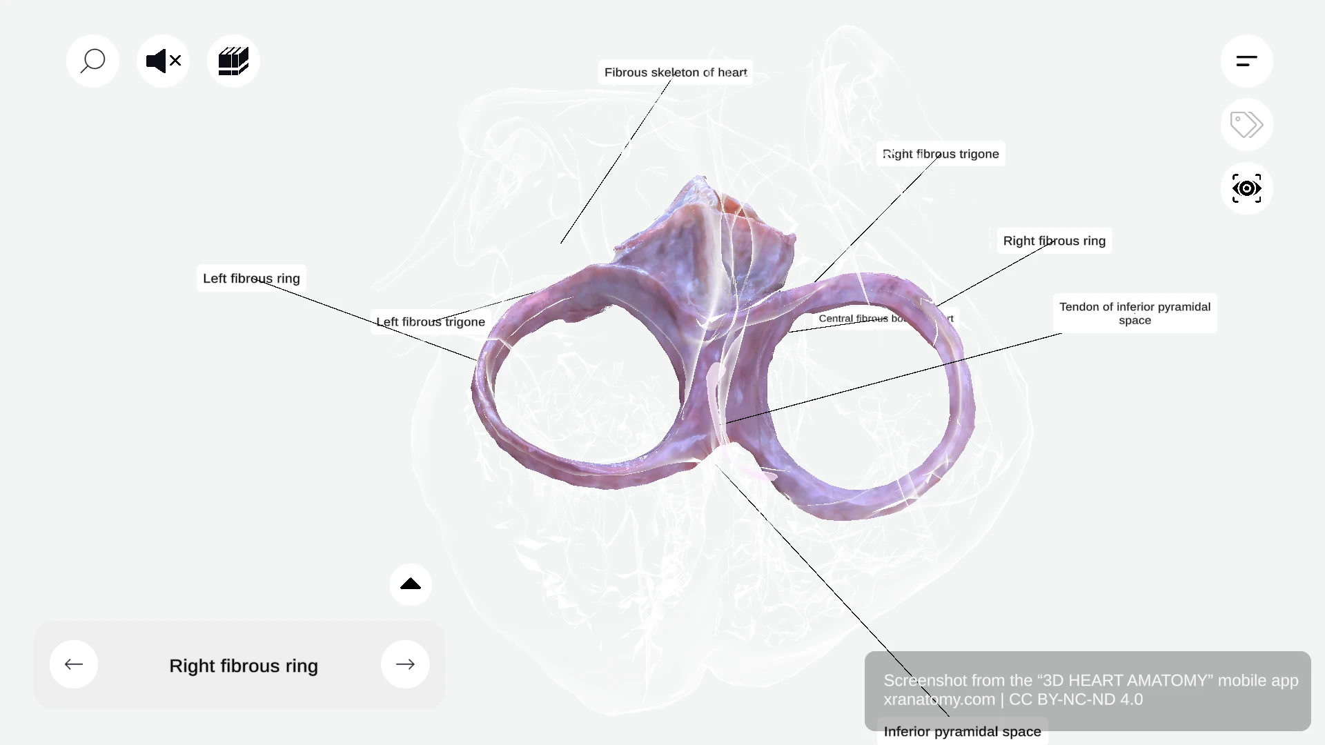 Fibrous rings of the heart showing right and left fibrous rings surrounding atrioventricular valve orifices
