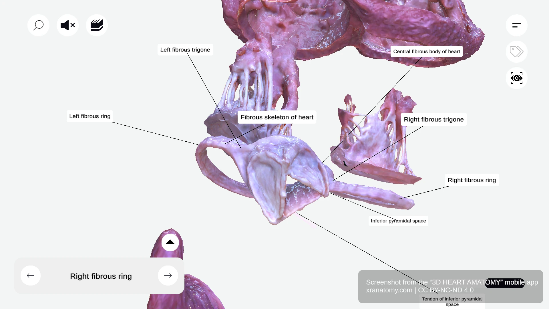Fibrous trigones of the heart showing right and left fibrous trigones between aortic and atrioventricular valves