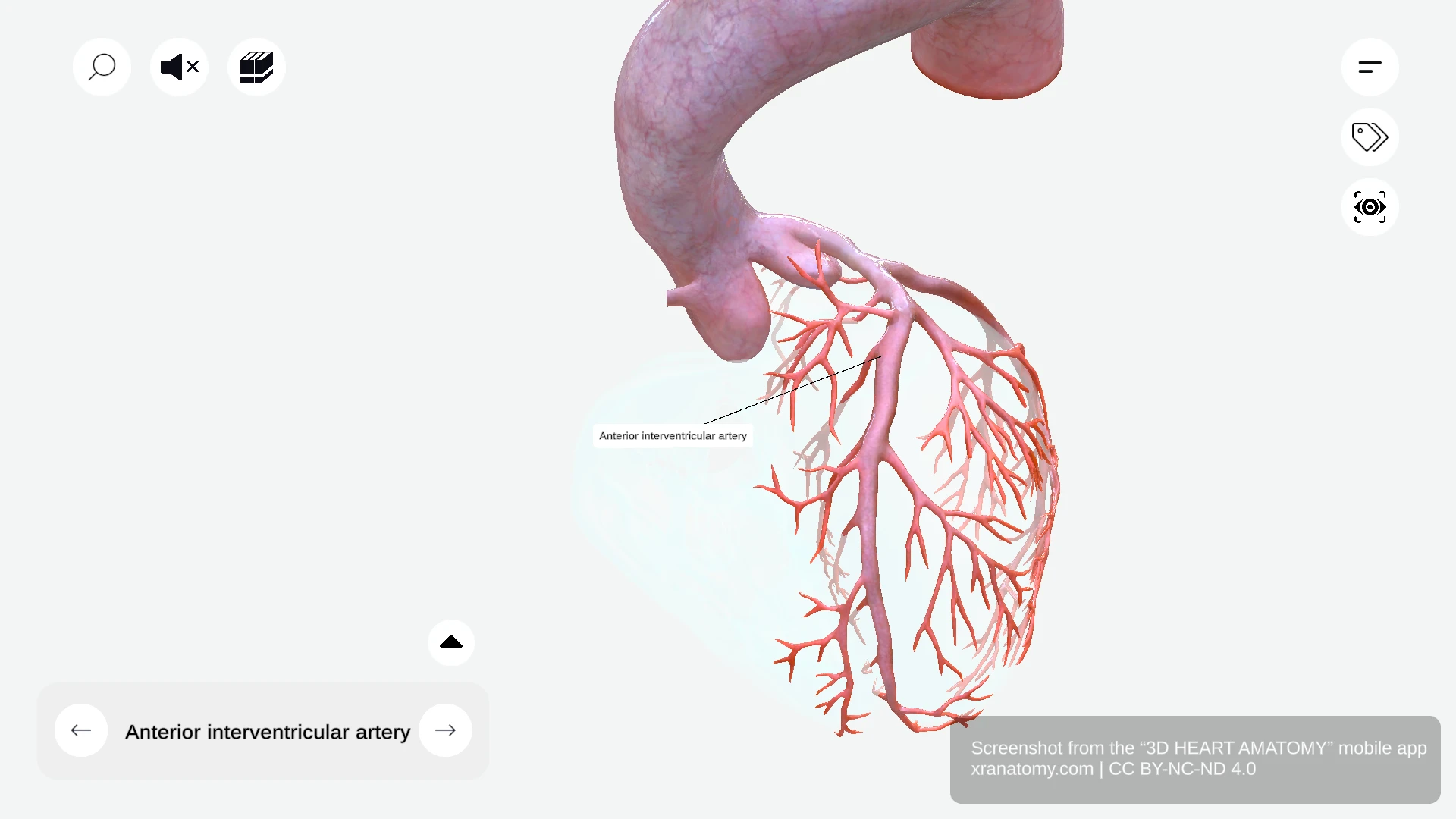 Anterior interventricular artery (left anterior descending) descending along interventricular sulcus with conal, diagonal, and septal branches