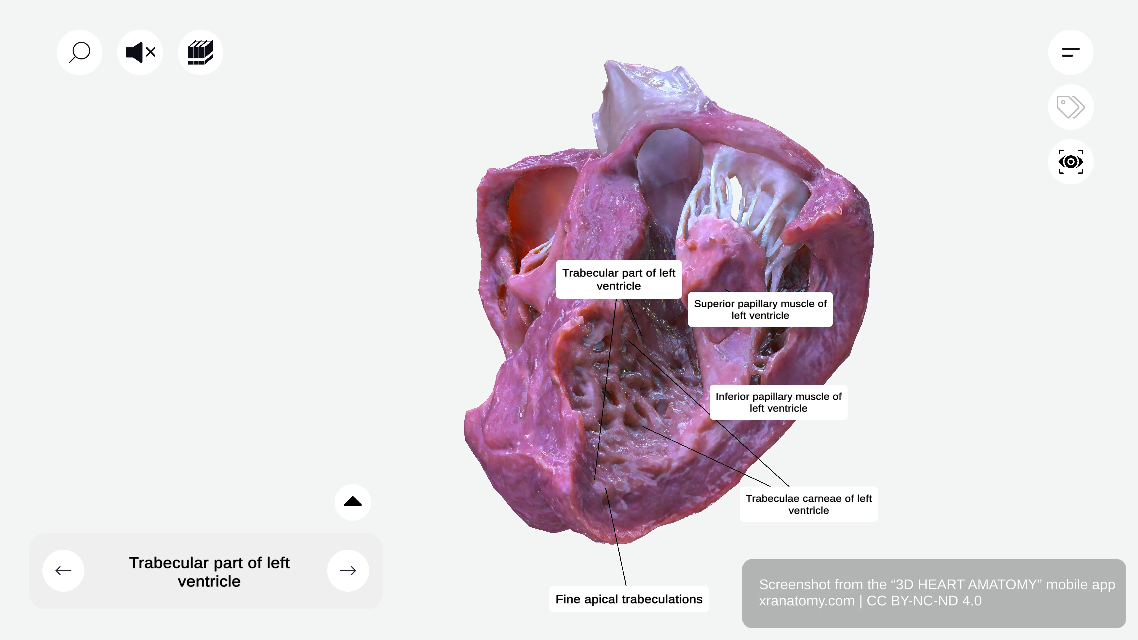 Trabecular part of left ventricle showing trabeculae carneae and fine apical trabeculations