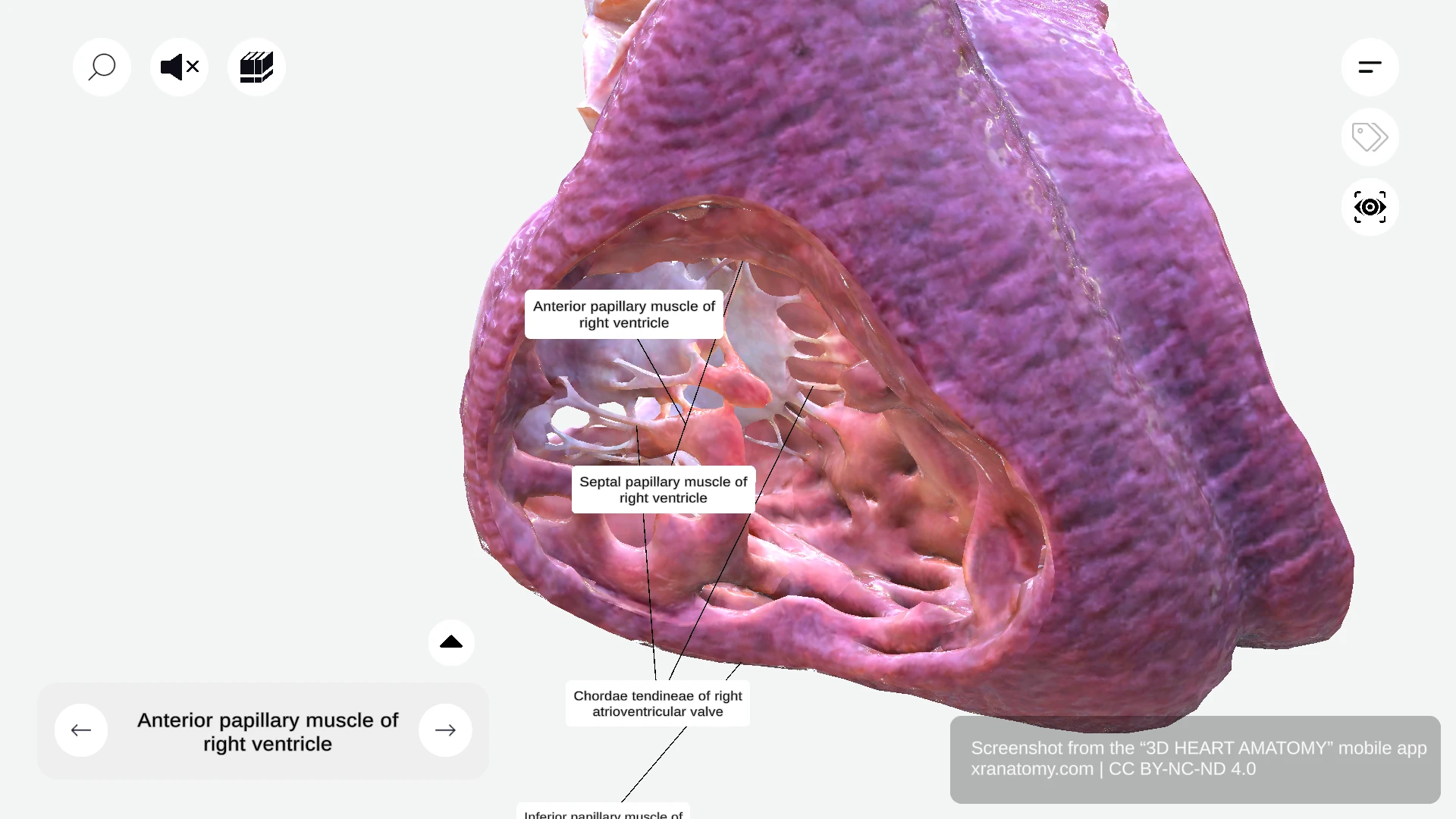 Chordae tendineae of right ventricle showing fibrous cords connecting papillary muscles to tricuspid valve leaflets
