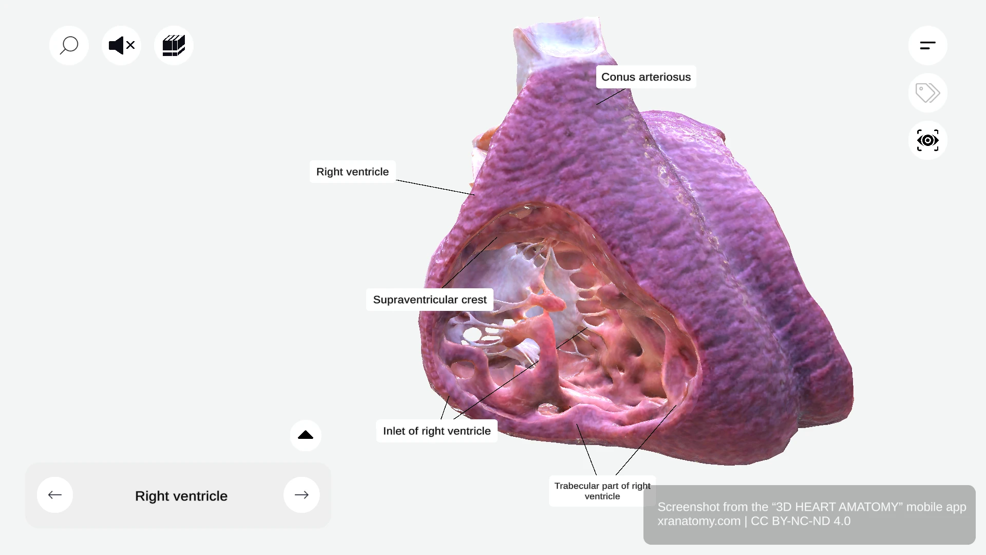 Inlet of right ventricle showing tricuspid valve apparatus with leaflets, chordae tendineae, and papillary muscles