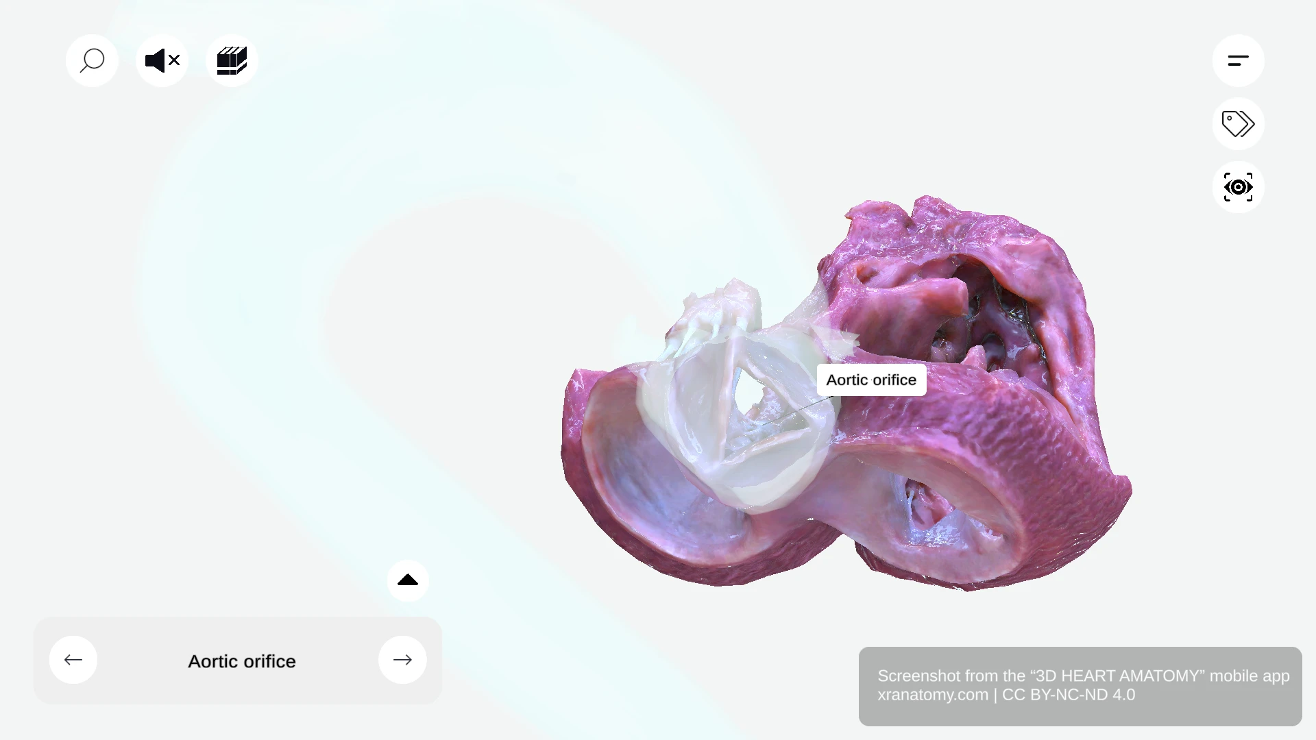 Aortic orifice showing the opening through which blood exits left ventricle, guarded by three aortic valve leaflets