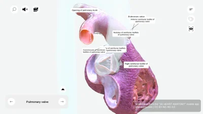 Root of Pulmonary Trunk