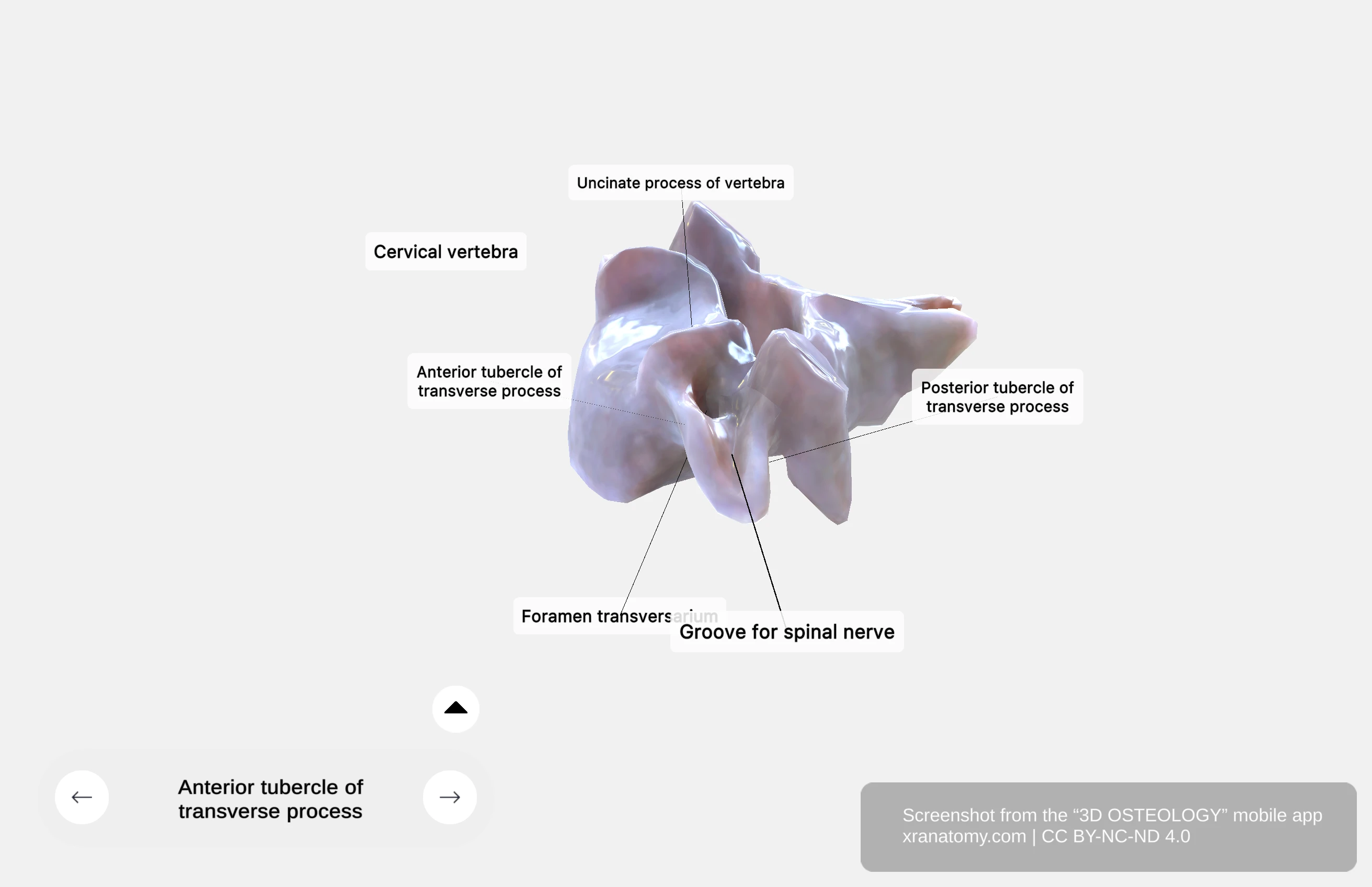 Anterior tubercle located in front of foramen transversarium on cervical vertebra transverse process with spinal nerve groove