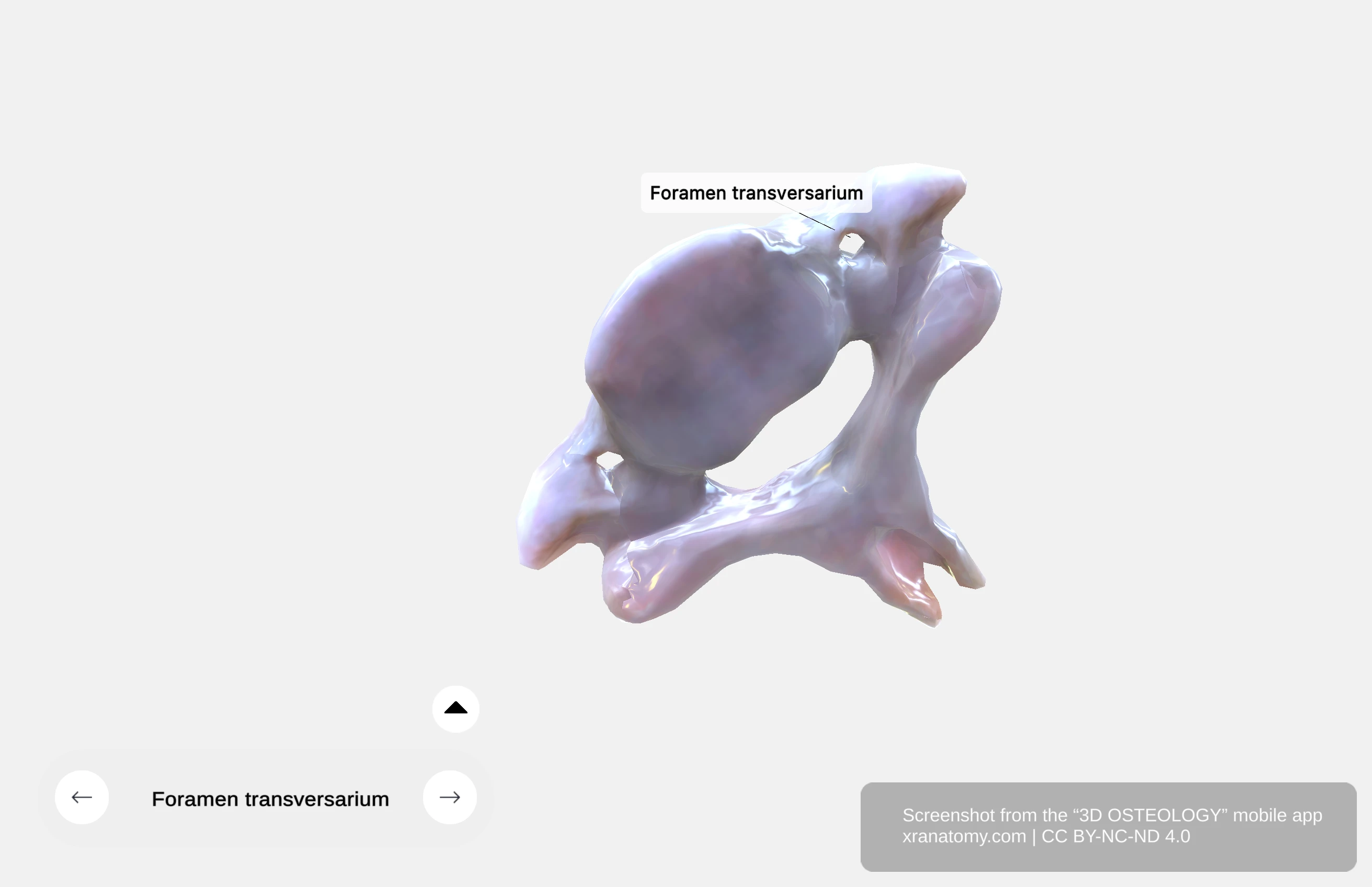 Foramen transversarium in transverse process transmitting vertebral artery vein and sympathetic nerves in C1-C6 cervical vertebrae